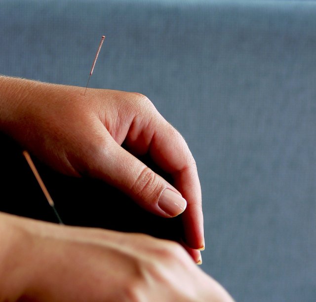 Acupuncture: A serviceable alternative to medication?