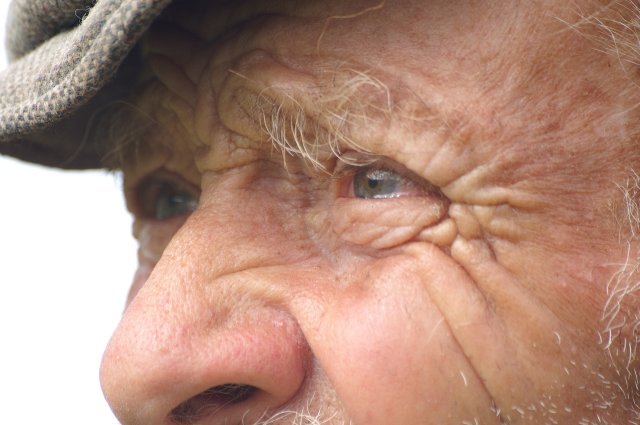 Can Age-related Vision Loss be Unnatural?