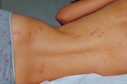 Don’t Let The Bed Bugs Bite!