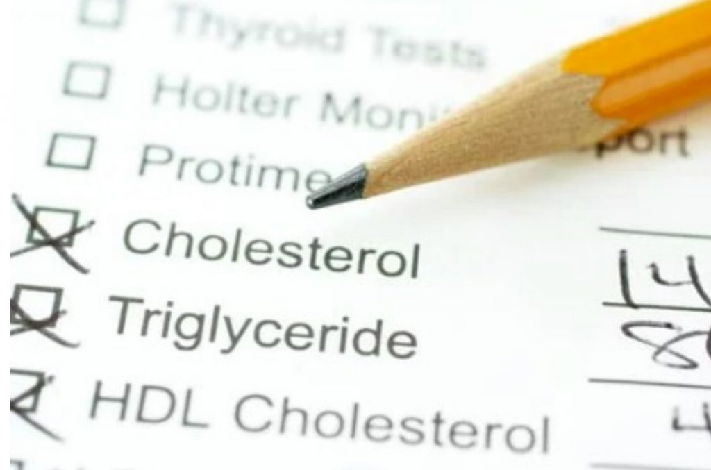 Check your cholesterol levels